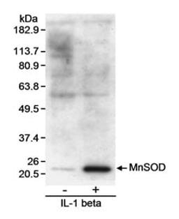 Detection of MnSOD by western blot.