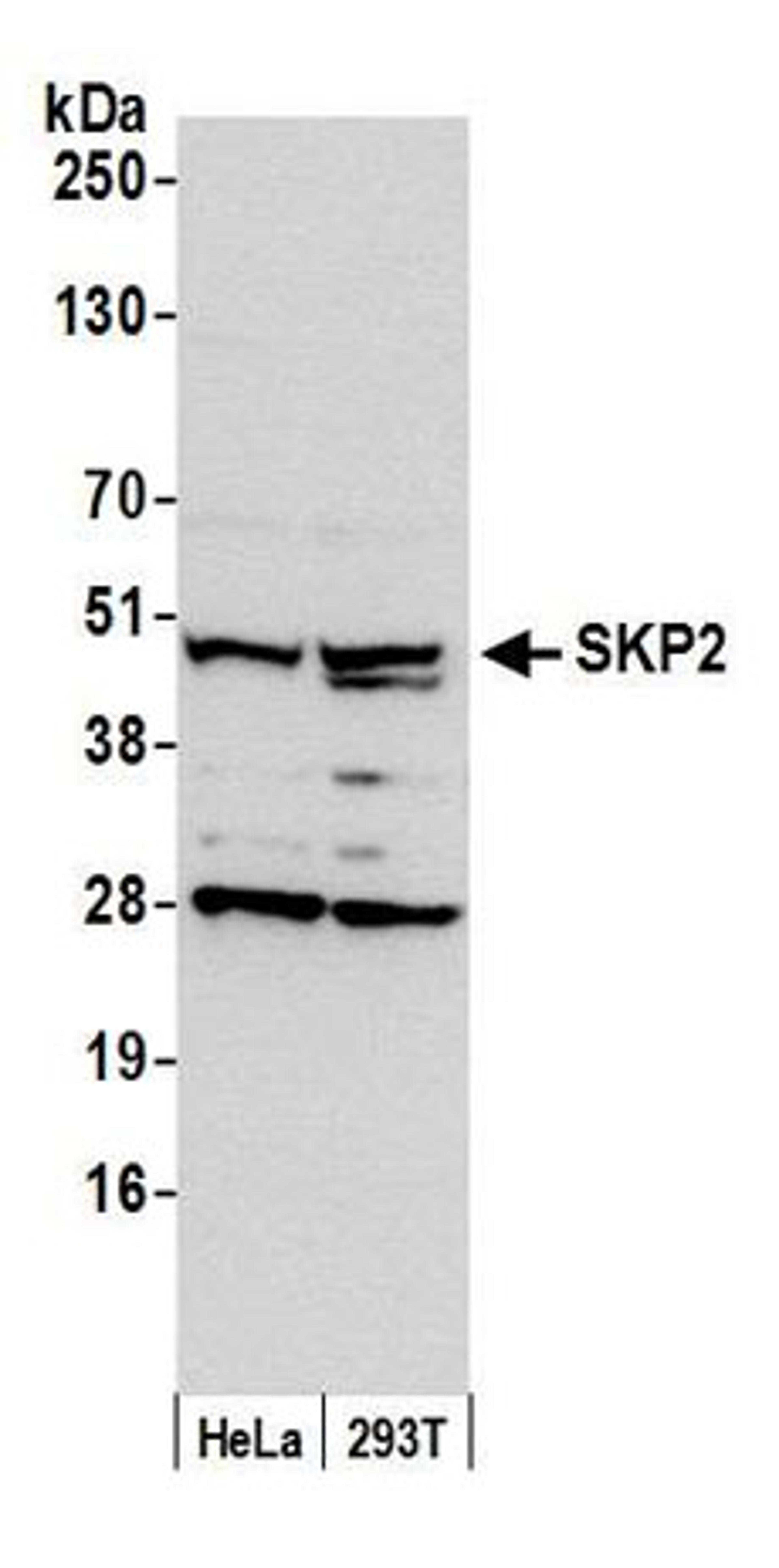 Detection of human SKP2 by western blot.