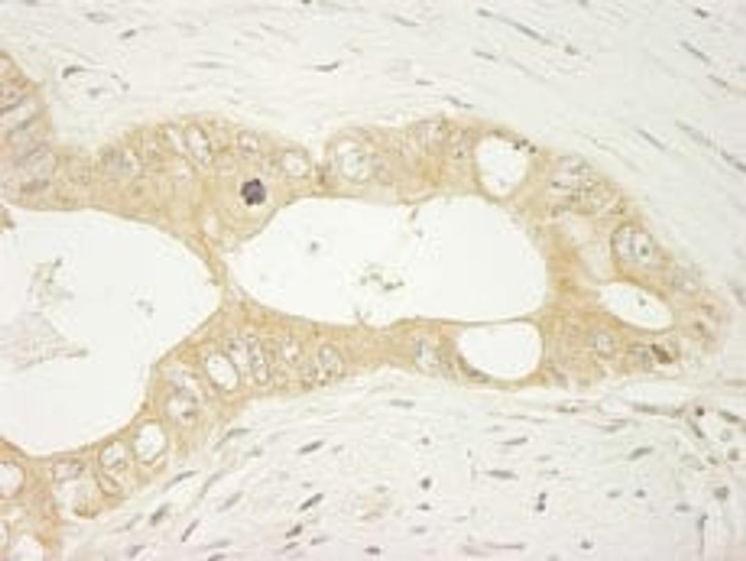 Detection of human LARP1 by immunohistochemistry.