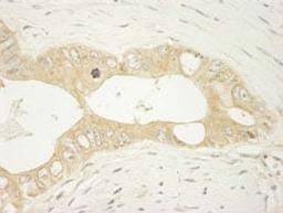 Detection of human LARP1 by immunohistochemistry.