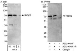 Detection of human RIOK2 by western blot and immunoprecipitation.