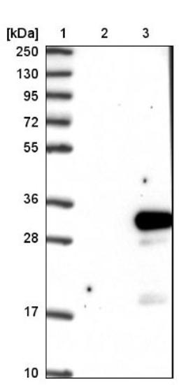 Western Blot: DTD1 Antibody [NBP1-88776] - Lane 1: Marker [kDa] 250, 130, 95, 72, 55, 36, 28, 17, 10<br/>Lane 2: Negative control (vector only transfected HEK293T lysate)<br/>Lane 3: Over-expression lysate (Co-expressed with a C-terminal myc-DDK tag (~3.1 kDa) in mammalian HEK293T cells, LY409024)