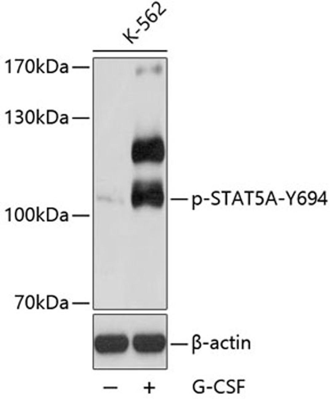 Western blot - Phospho-STAT5A-Y694 antibody (AP0138)