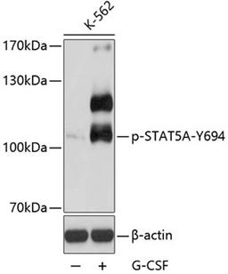 Western blot - Phospho-STAT5A-Y694 antibody (AP0138)