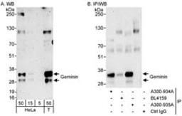 Detection of human Geminin by western blot and immunoprecipitation.