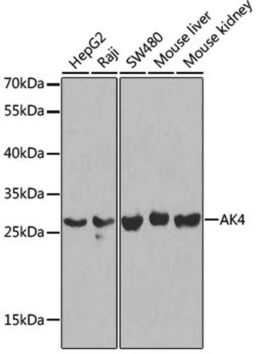 Western blot - AK4 antibody (A2050)