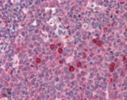 Immunohistochemistry-Paraffin: SEC6 Antibody (9H5) [NBP1-97500] - Analysis of human tonsil tissue stained with rSec6, mAb (9H5) at 10ug/ml.