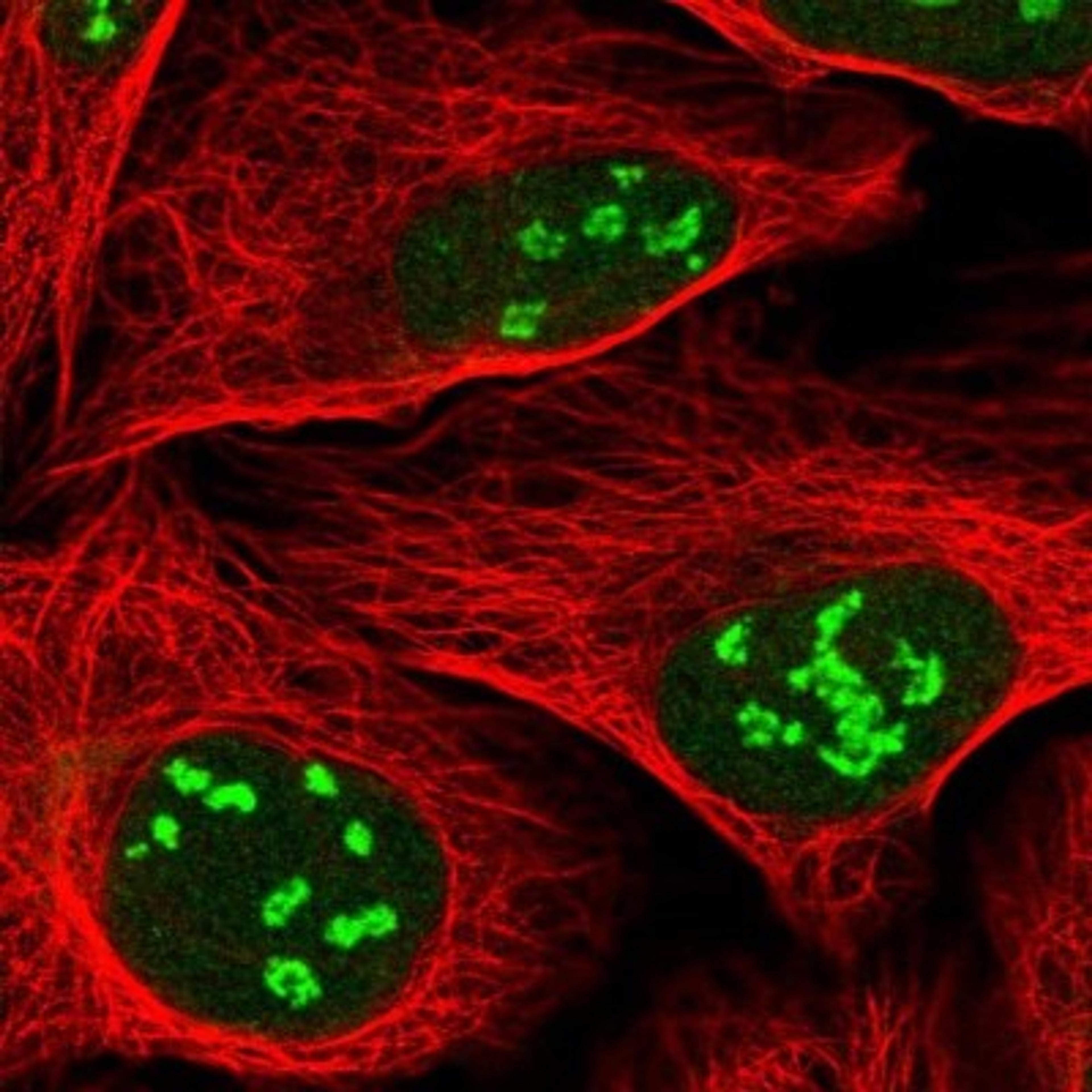 Immunocytochemistry/Immunofluorescence: MSL3L1 Antibody [NBP1-87881] - Staining of human cell line U-2 OS shows positivity in nucleus & nucleoli.