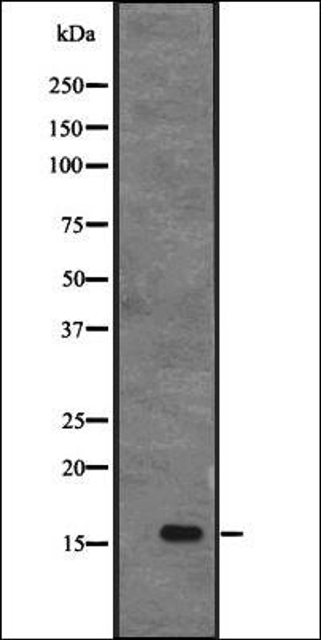 Western blot analysis of MHF1 transfected 293T cell lysate using CENPS antibody