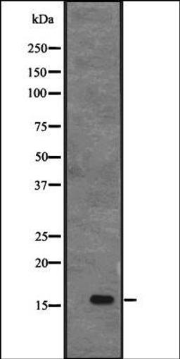 Western blot analysis of MHF1 transfected 293T cell lysate using CENPS antibody