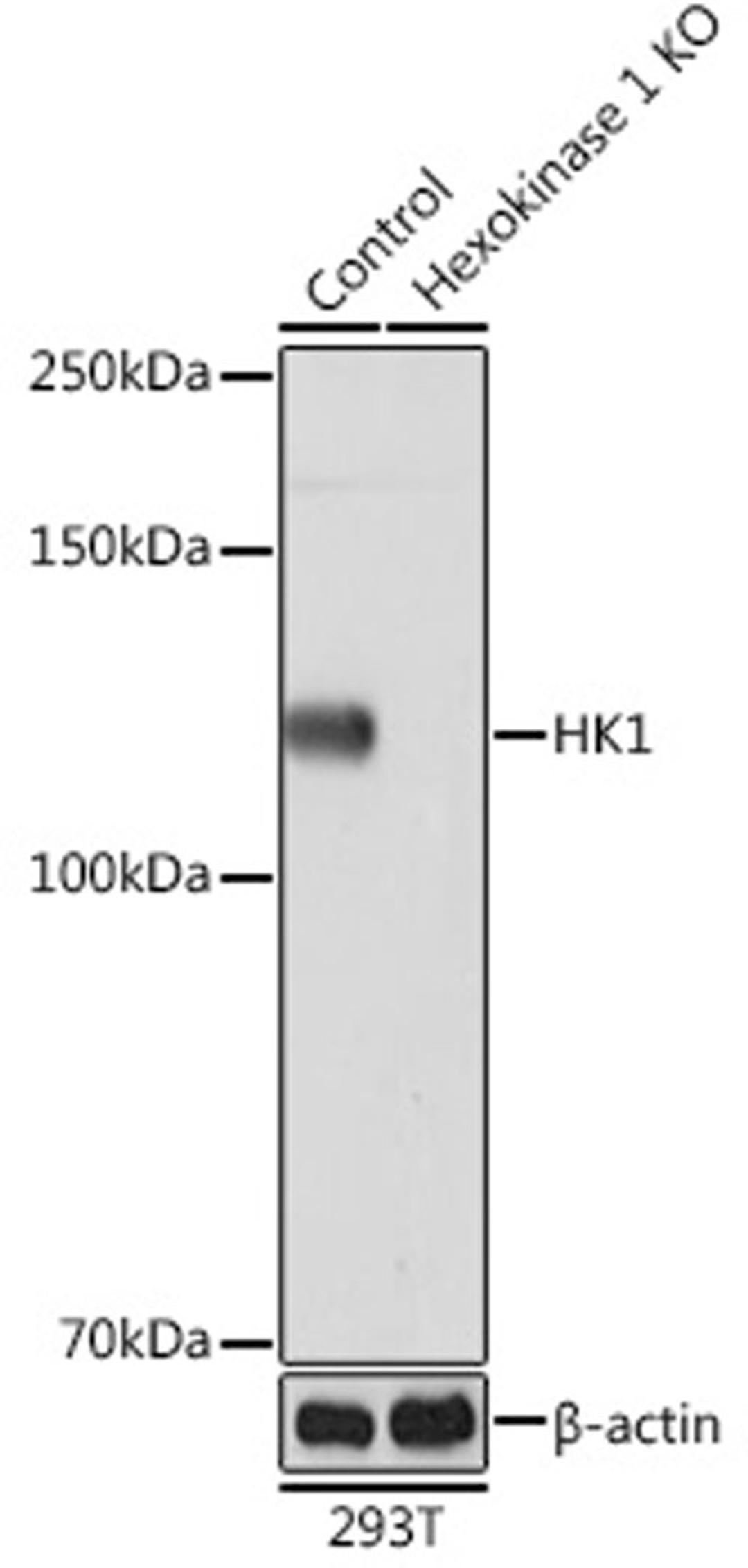 Western blot - HK1 Rabbit mAb (A0533)