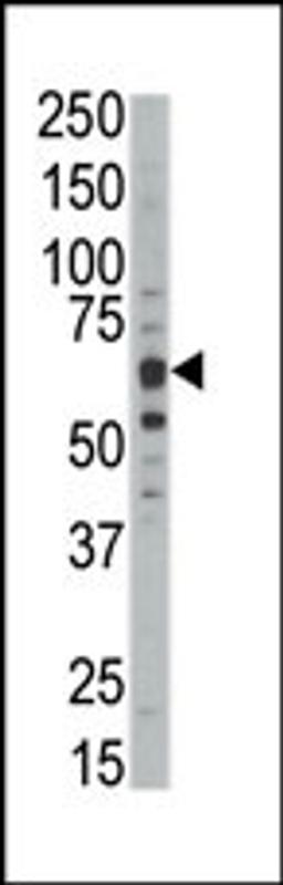 Western blot analysis of anti-DYRKB Pab in mouse kidney tissue lysate