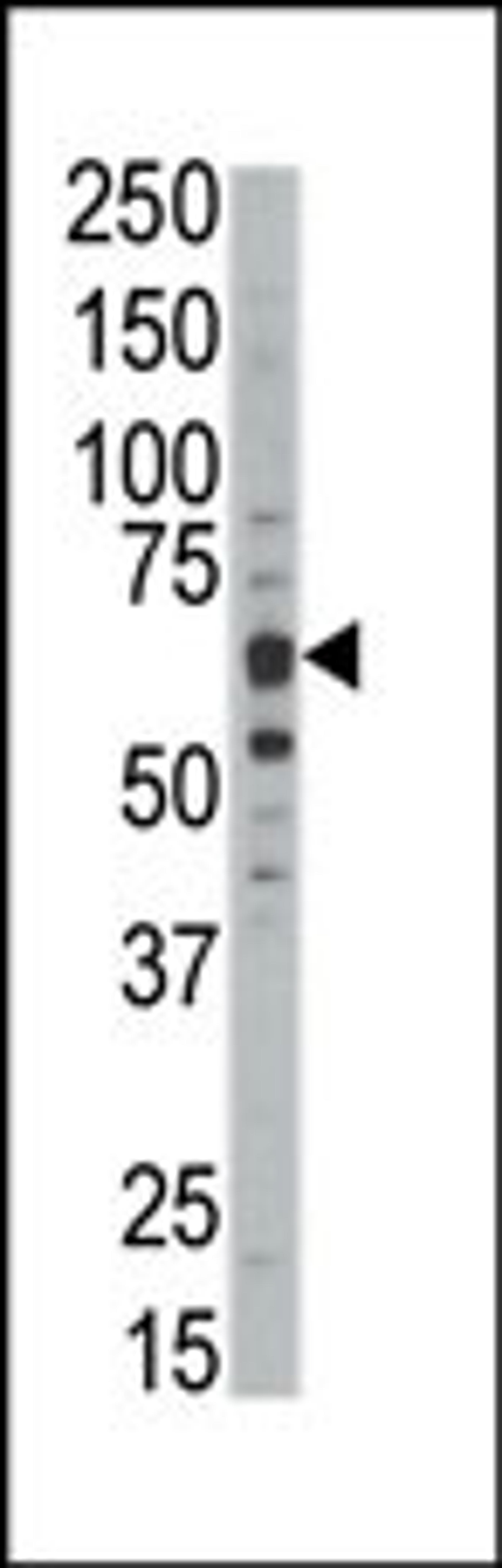 Western blot analysis of anti-DYRKB Pab in mouse kidney tissue lysate