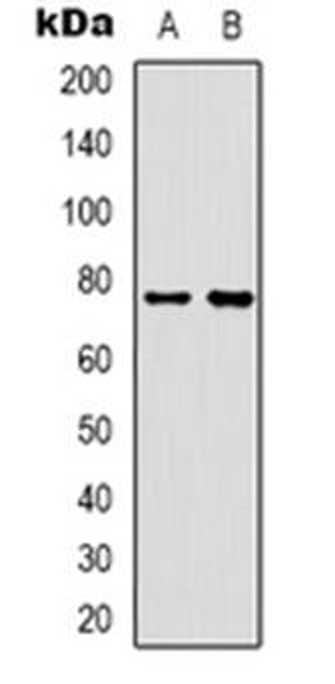 Western blot analysis of Rabphilin 3A expression in Hela (Lane 1), mouse muscle (Lane 2) whole cell lysates using RPH3A antibody