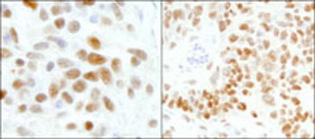 Detection of human and mouse GTF2I/TFII-I by immunohistochemistry.