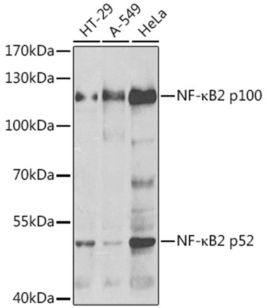 Western blot - NF-?B2 antibody (A5567)