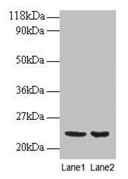 Western blot. All lanes: PRDX1 antibody at 2µg/ml. Lane 1: EC109 whole cell lysate. Lane 2: 293T whole cell lysate. Secondary. Goat polyclonal to rabbit IgG at 1/15000 dilution. Predicted band size: 23 kDa. Observed band size: 23 kDa