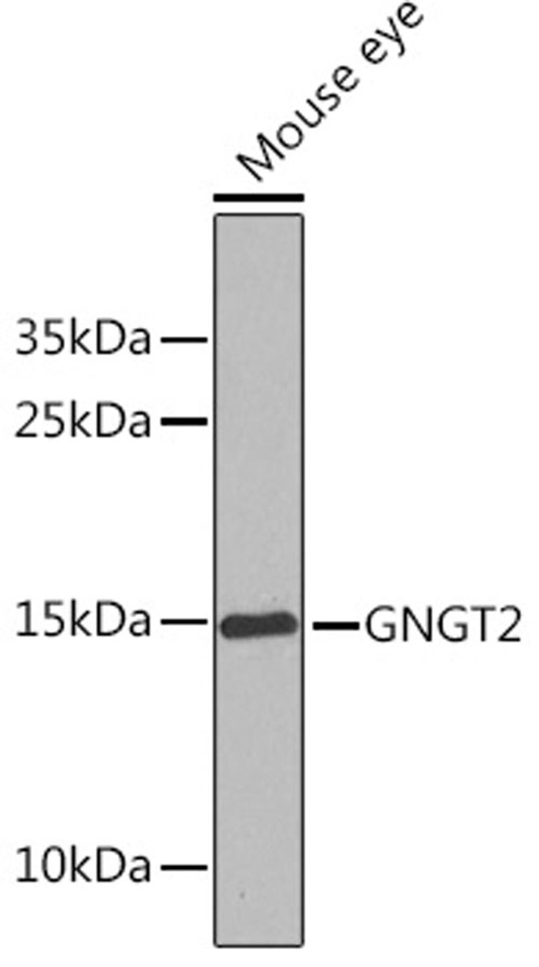 Western blot - GNGT2 Rabbit pAb (A9818)