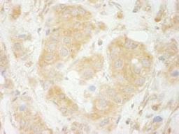 Detection of human Sec23IP(MSTP053) by immunohistochemistry.