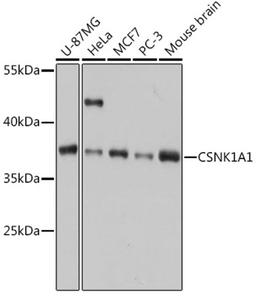 Western blot - CSNK1A1 antibody (A16225)