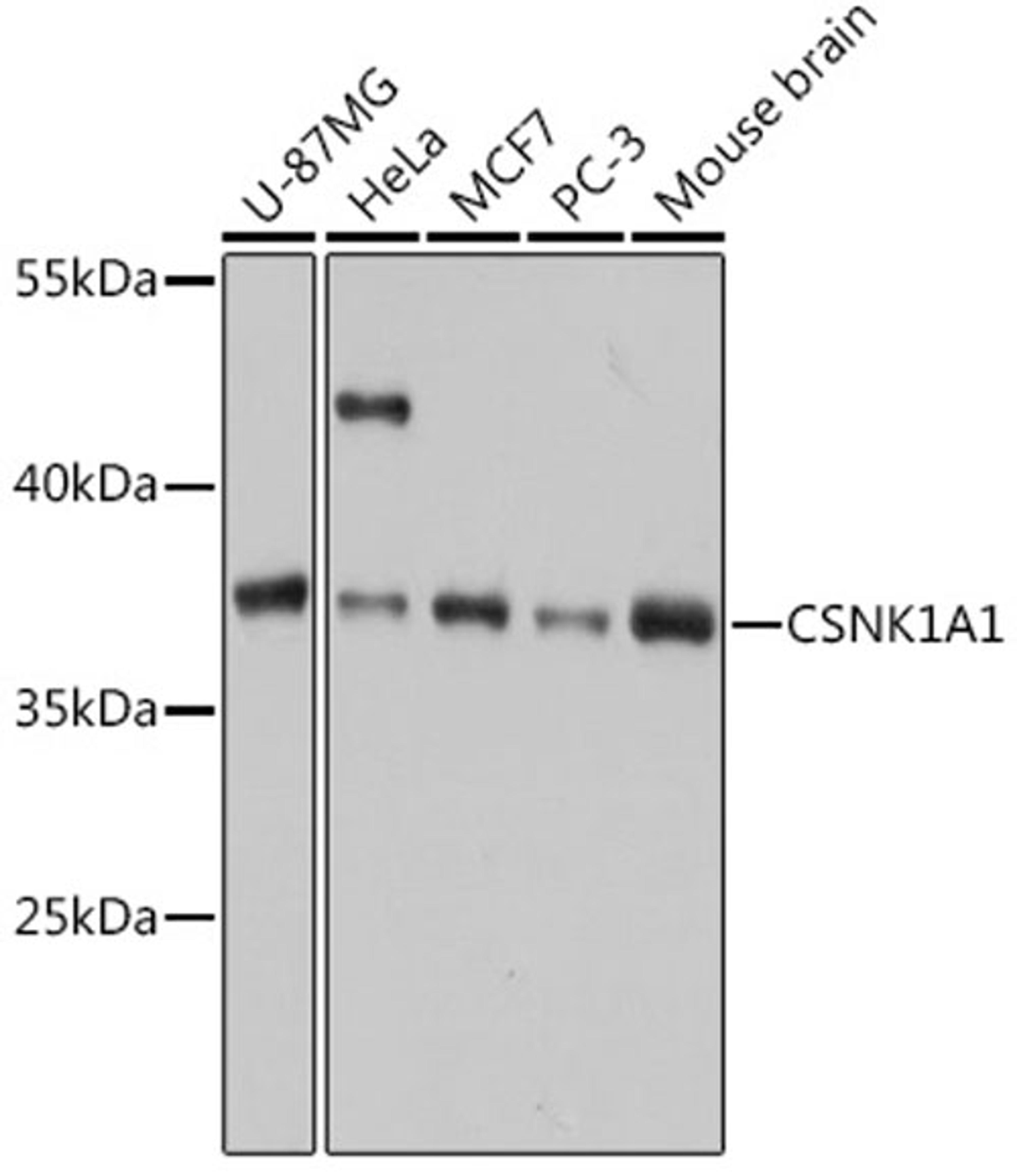 Western blot - CSNK1A1 antibody (A16225)