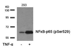 Western blot analysis of lysed extracts from 293 cells untreated or treated with TNF-α using NFκB-p65 (Phospho-Ser529).