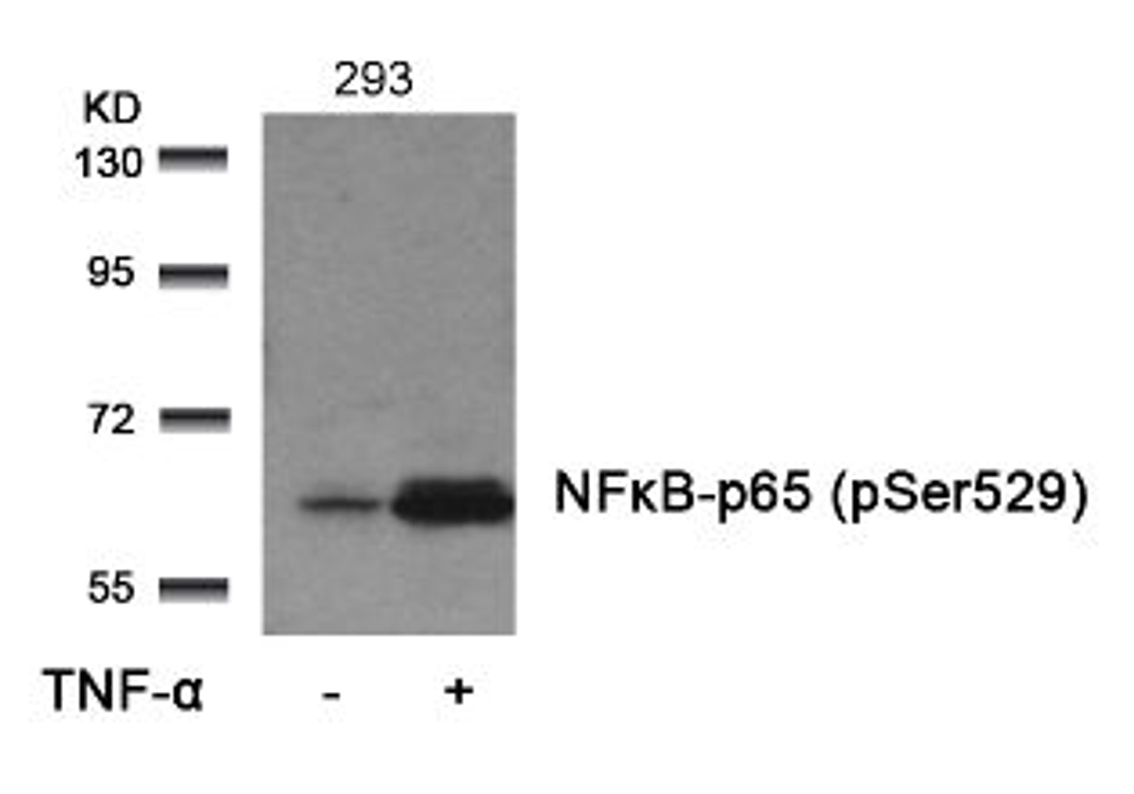 Western blot analysis of lysed extracts from 293 cells untreated or treated with TNF-α using NFκB-p65 (Phospho-Ser529).