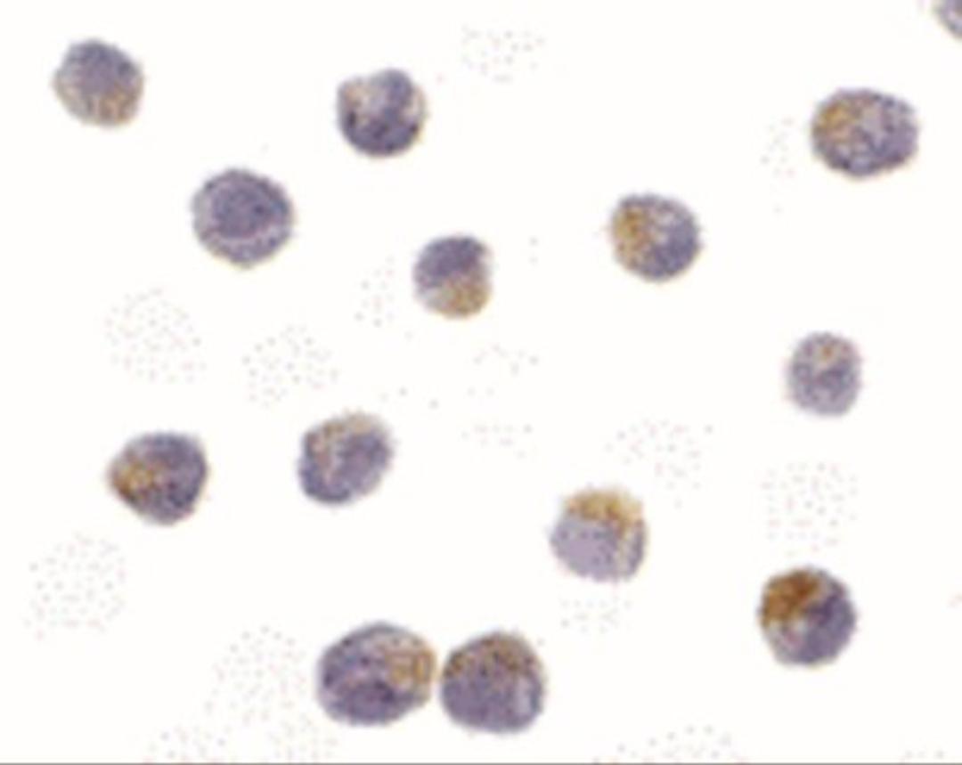 Immunocytochemistry: DRAK2 Antibody [NBP1-76885] - Jurkat cells with DRAK2 antibody at 10 ug/mL.