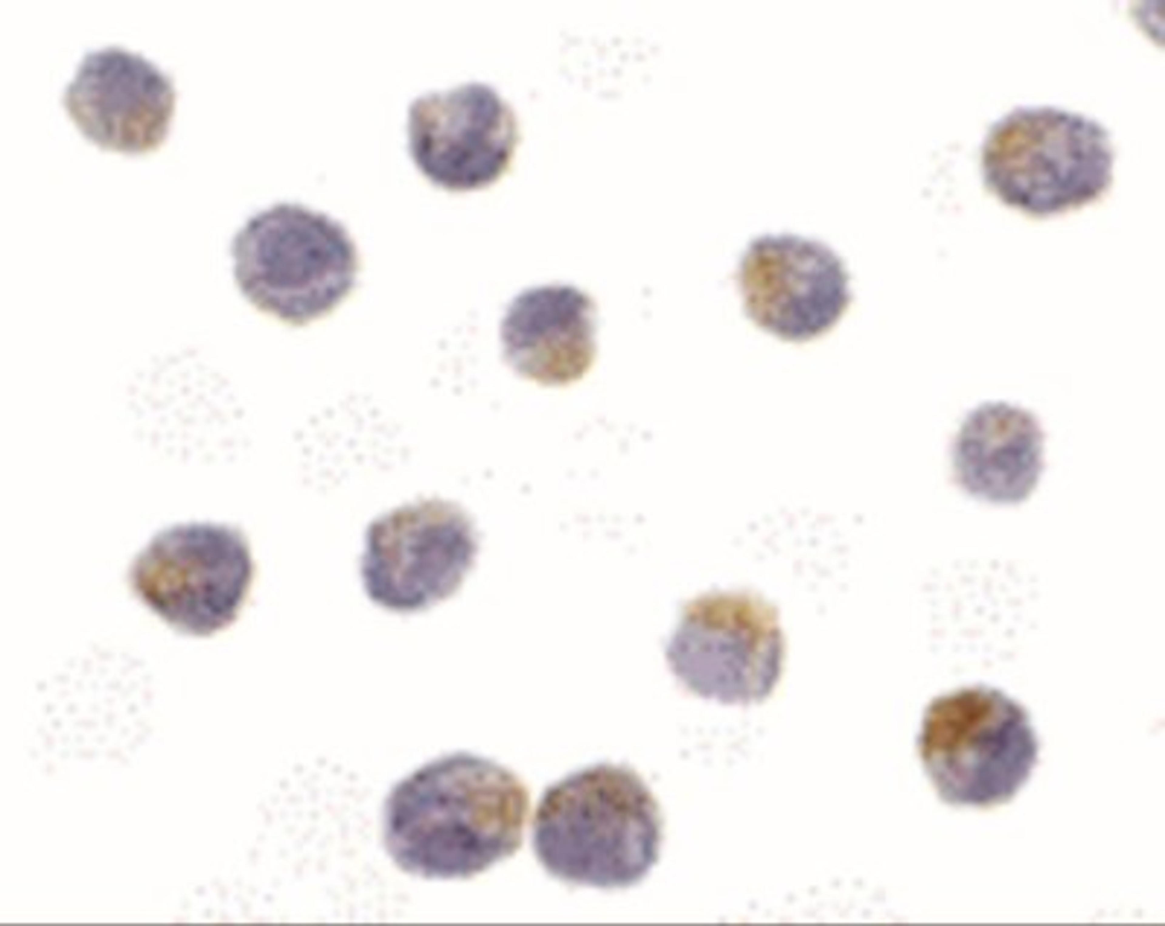 Immunocytochemistry: DRAK2 Antibody [NBP1-76885] - Jurkat cells with DRAK2 antibody at 10 ug/mL.