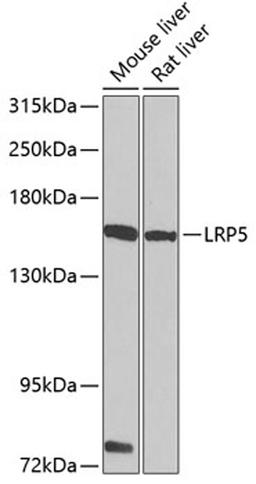 Western blot - LRP5 antibody (A0130)