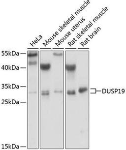 Western blot - DUSP19 antibody (A6227)