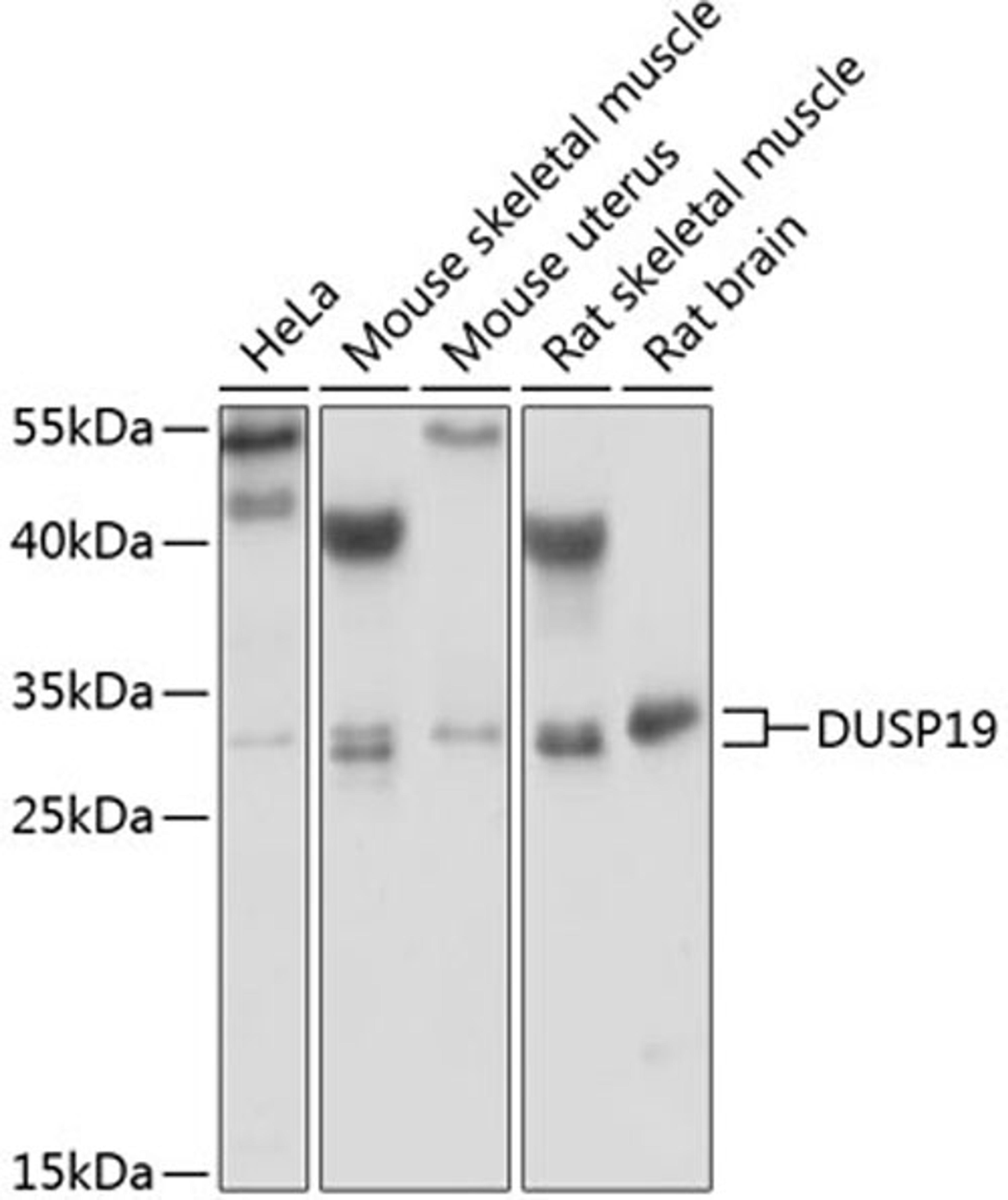 Western blot - DUSP19 antibody (A6227)