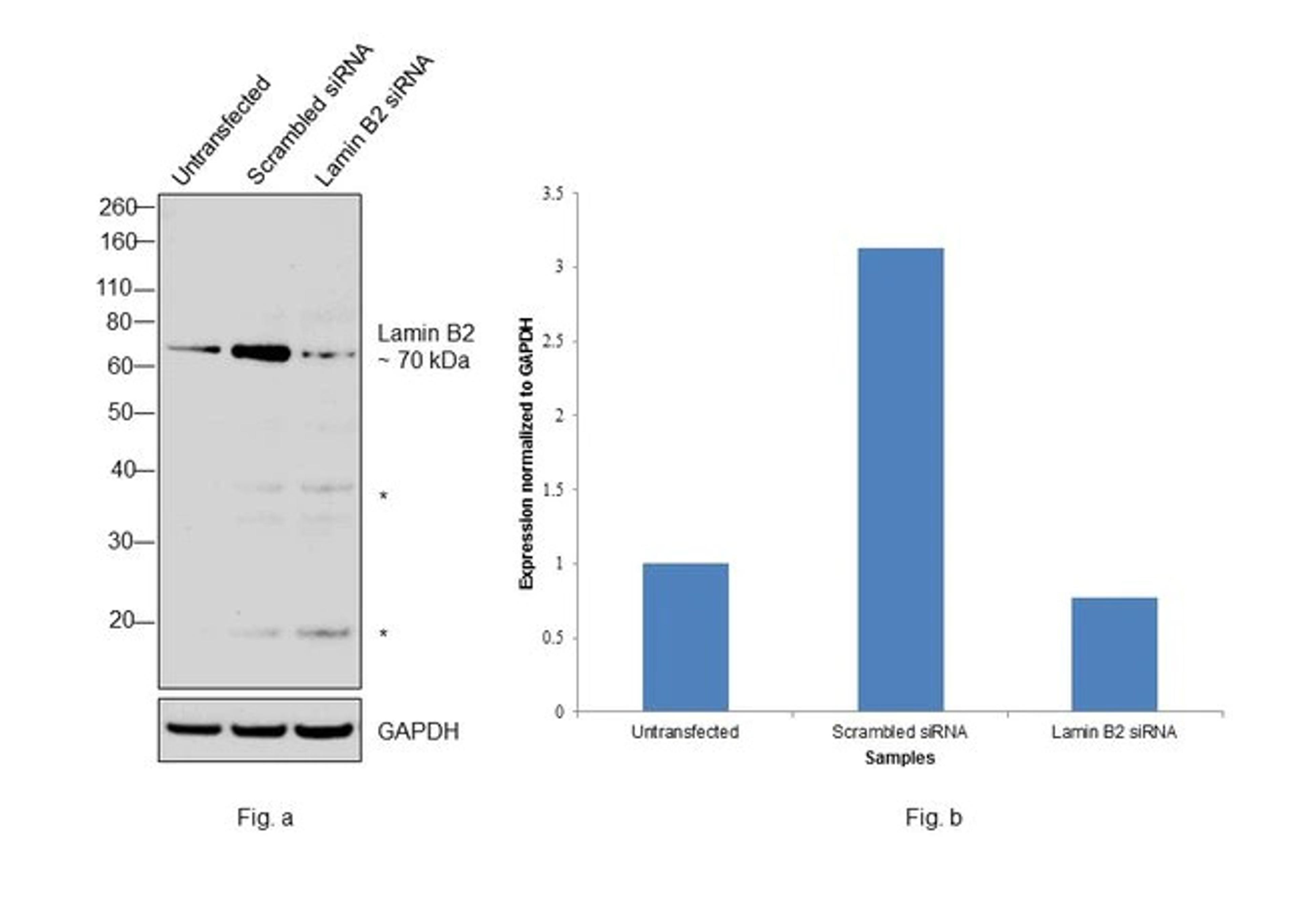 Lamin B2 Antibody (33-2100) in WB