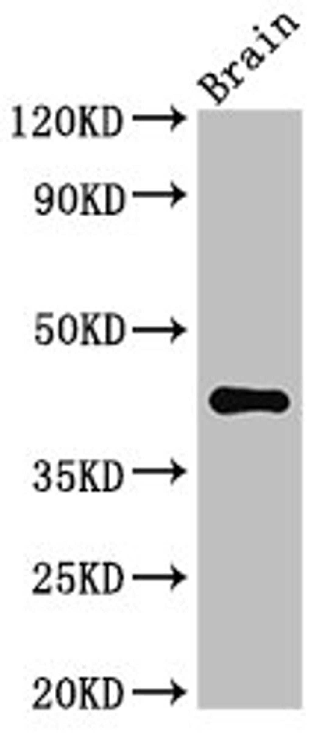 Western Blot. Positive WB detected in: Mouse brain tissue. All lanes: AGPAT5 antibody at 3.4ug/ml. Secondary. Goat polyclonal to rabbit IgG at 1/50000 dilution. Predicted band size: 43 kDa. Observed band size: 43 kDa.