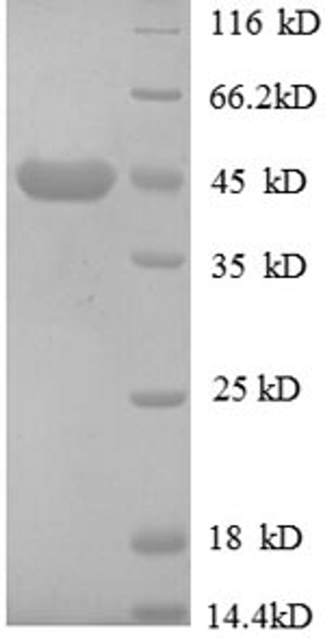 (Tris-Glycine gel) Discontinuous SDS-PAGE (reduced) with 5% enrichment gel and 15% separation gel.