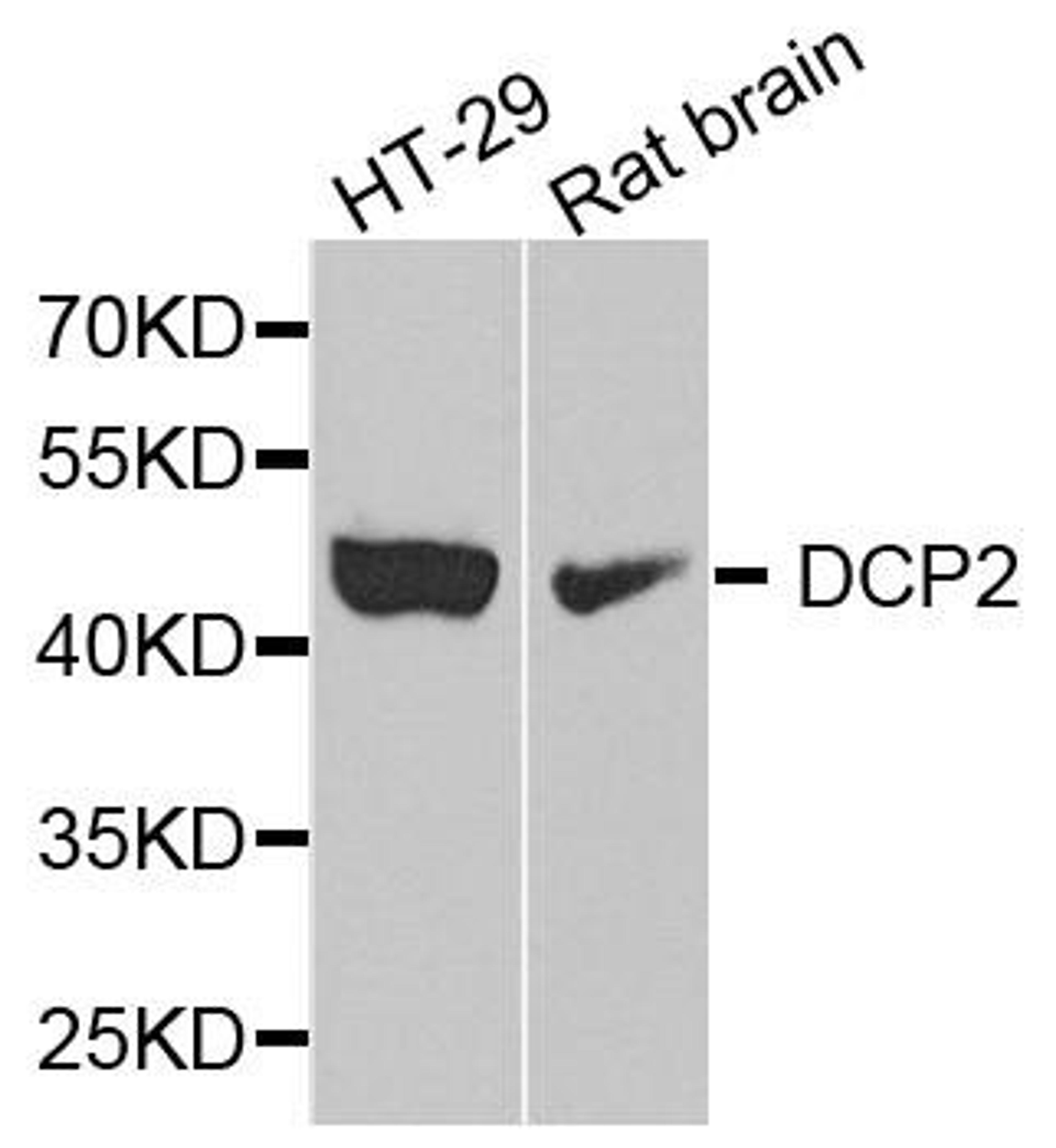 Western blot analysis of extract of various cells using DCP2 antibody