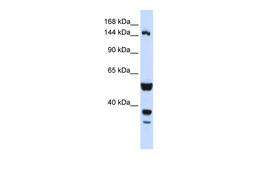 Antibody used in WB on Human HeLa at 0.2-1 ug/ml.