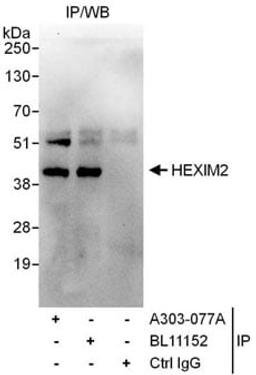 Detection of human HEXIM2 by western blot of immunoprecipitates.