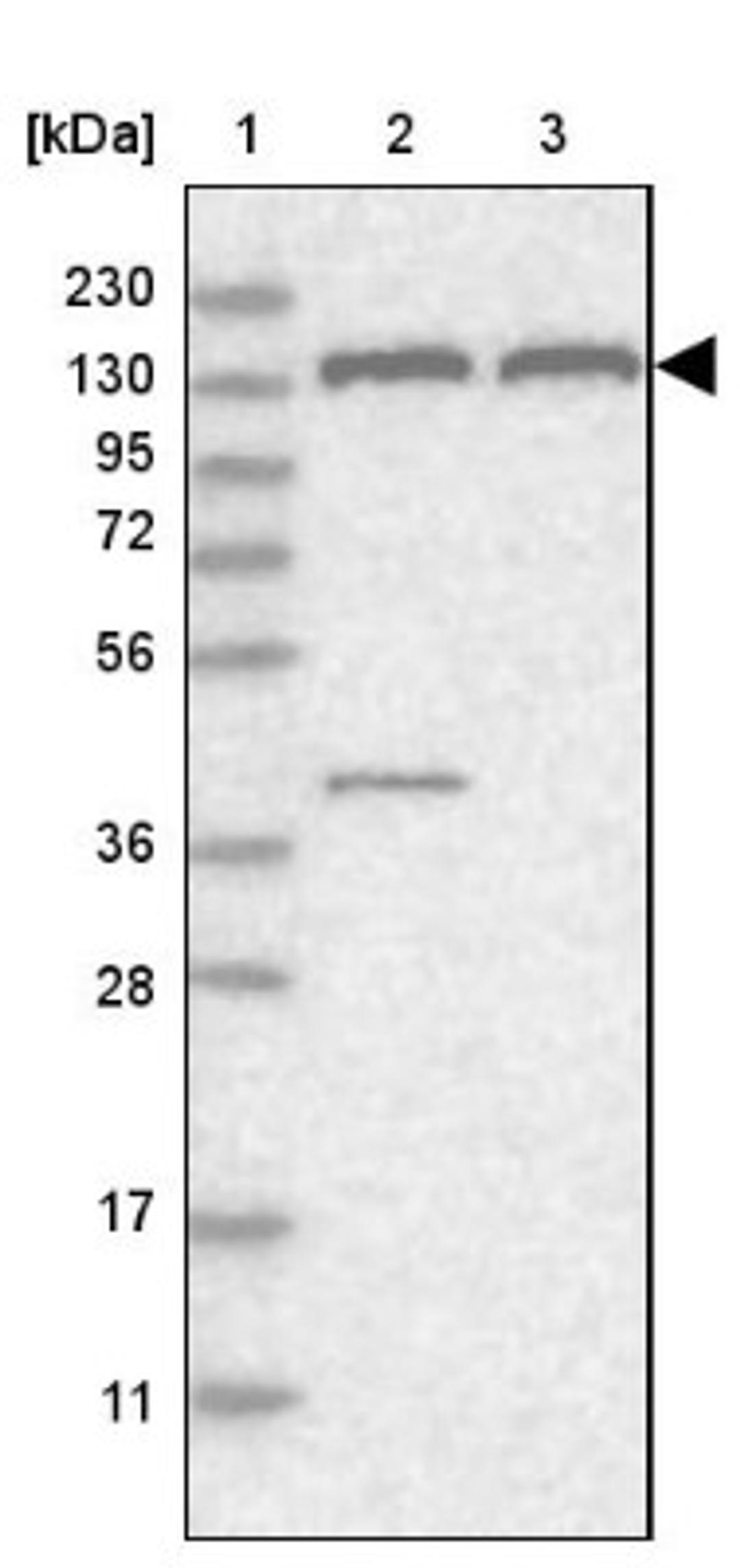 Western Blot: PEX1 Antibody [NBP1-80577] - Lane 1: Marker [kDa] 230, 130, 95, 72, 56, 36, 28, 17, 11<br/>Lane 2: Human cell line RT-4<br/>Lane 3: Human cell line U-251MG sp