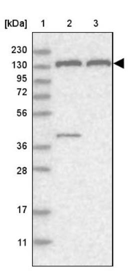 Western Blot: PEX1 Antibody [NBP1-80577] - Lane 1: Marker [kDa] 230, 130, 95, 72, 56, 36, 28, 17, 11<br/>Lane 2: Human cell line RT-4<br/>Lane 3: Human cell line U-251MG sp