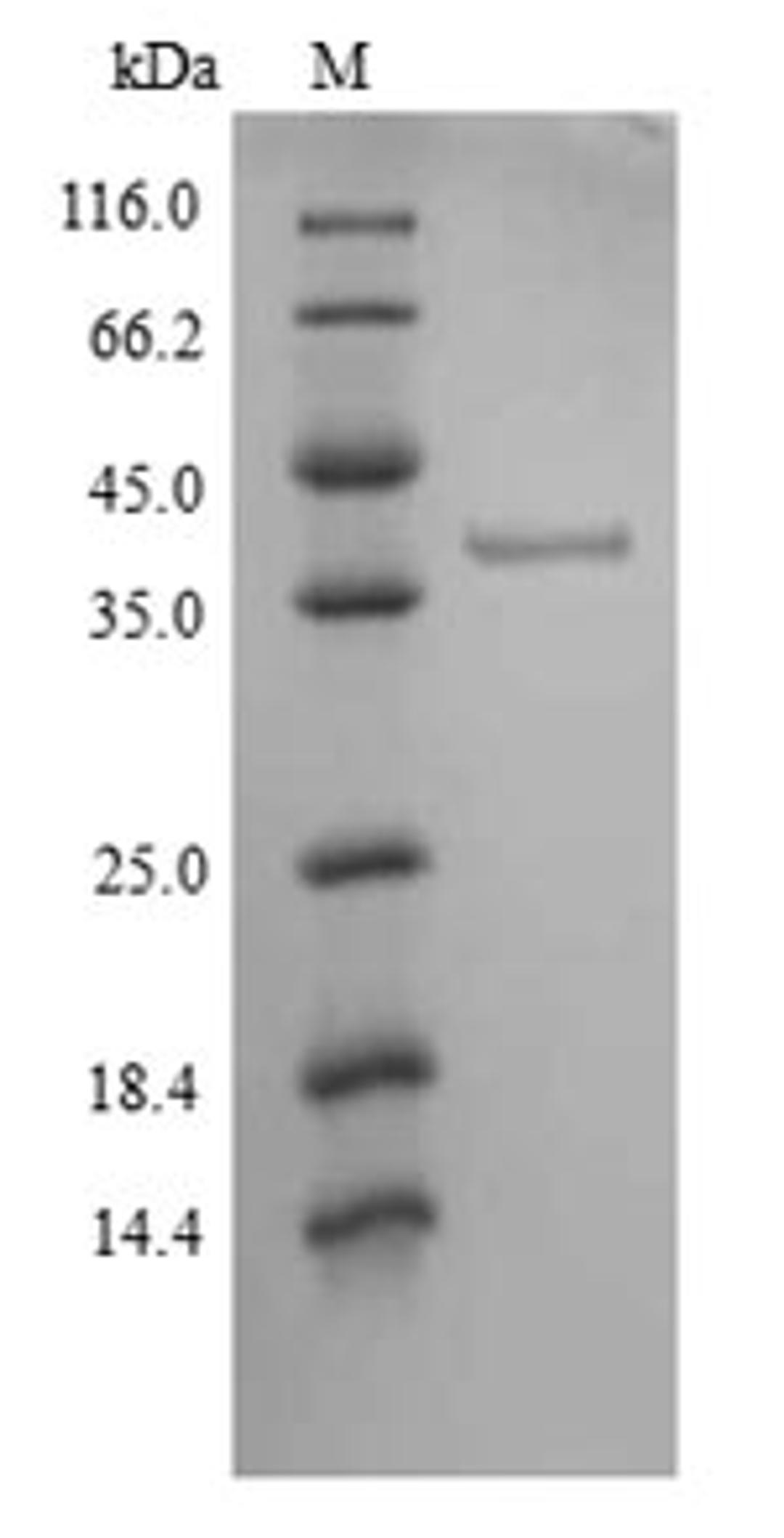 (Tris-Glycine gel) Discontinuous SDS-PAGE (reduced) with 5% enrichment gel and 15% separation gel.