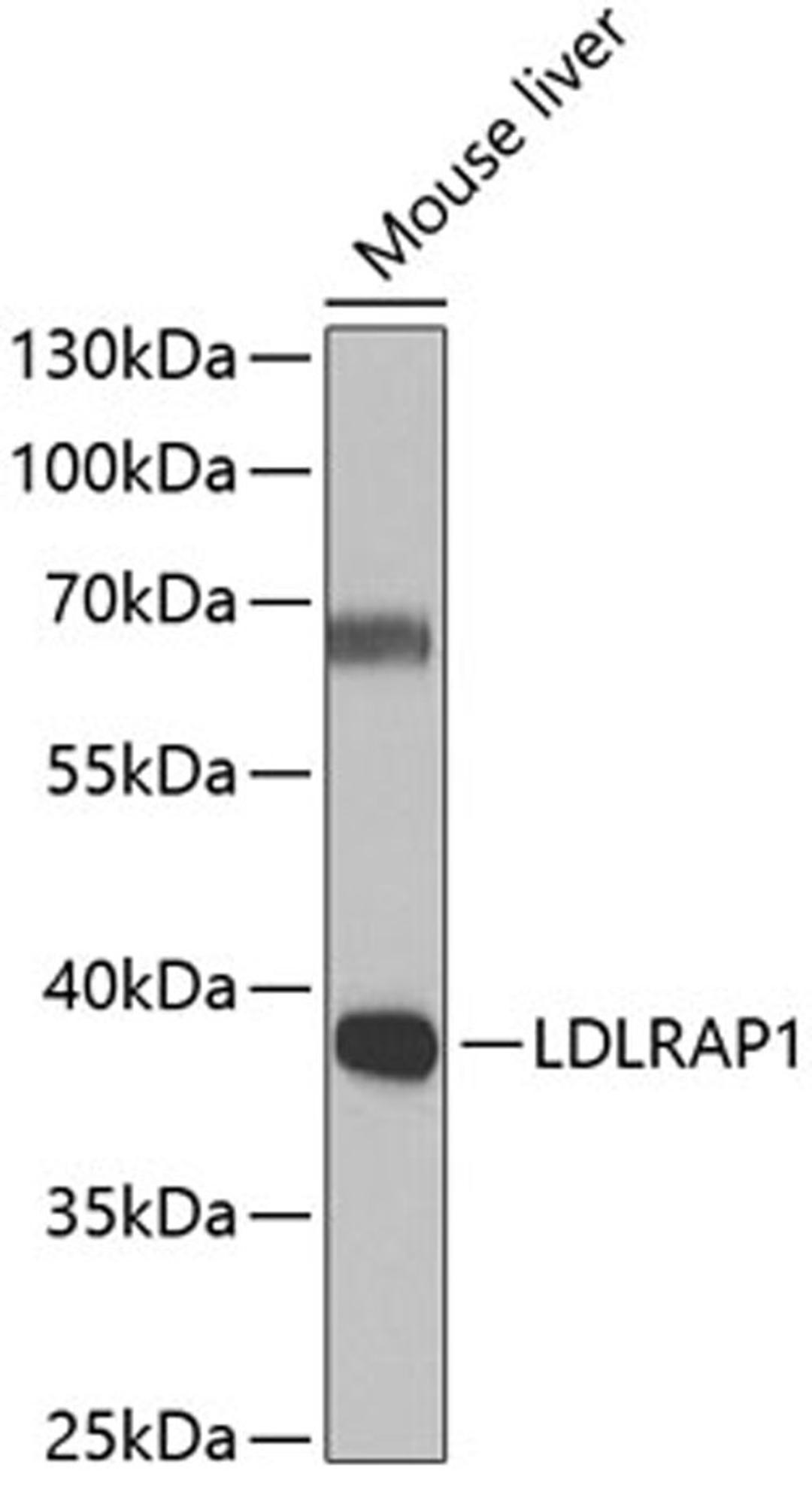 Western blot - LDLRAP1 antibody (A7093)