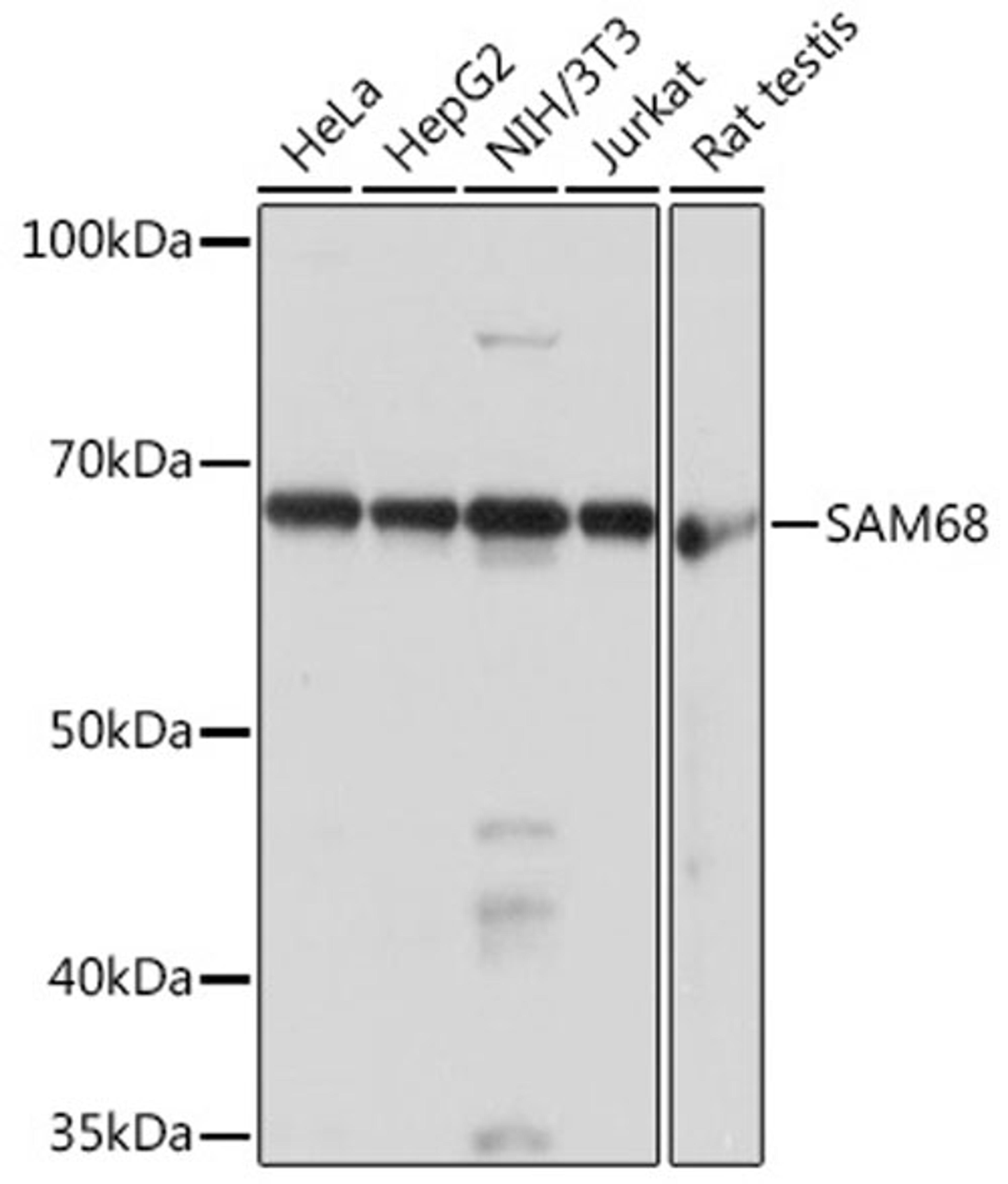 Western blot - SAM68 Rabbit mAb (A3886)