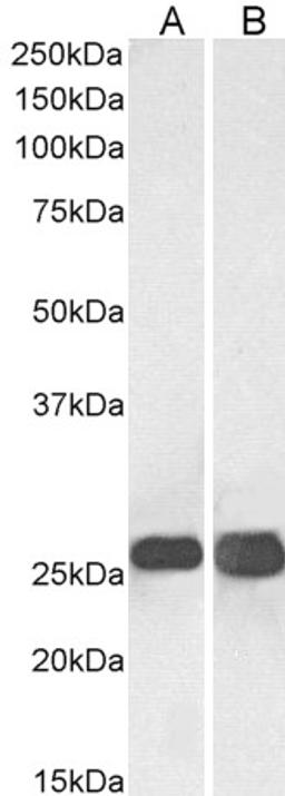 45-149 (0.03ug/ml) staining of Human Brain (Cerebellum) (A) and Mouse Brain (B lysates (35ug protein in RIPA buffer). Primary incubation was 1 hour. Detected by chemiluminescence.