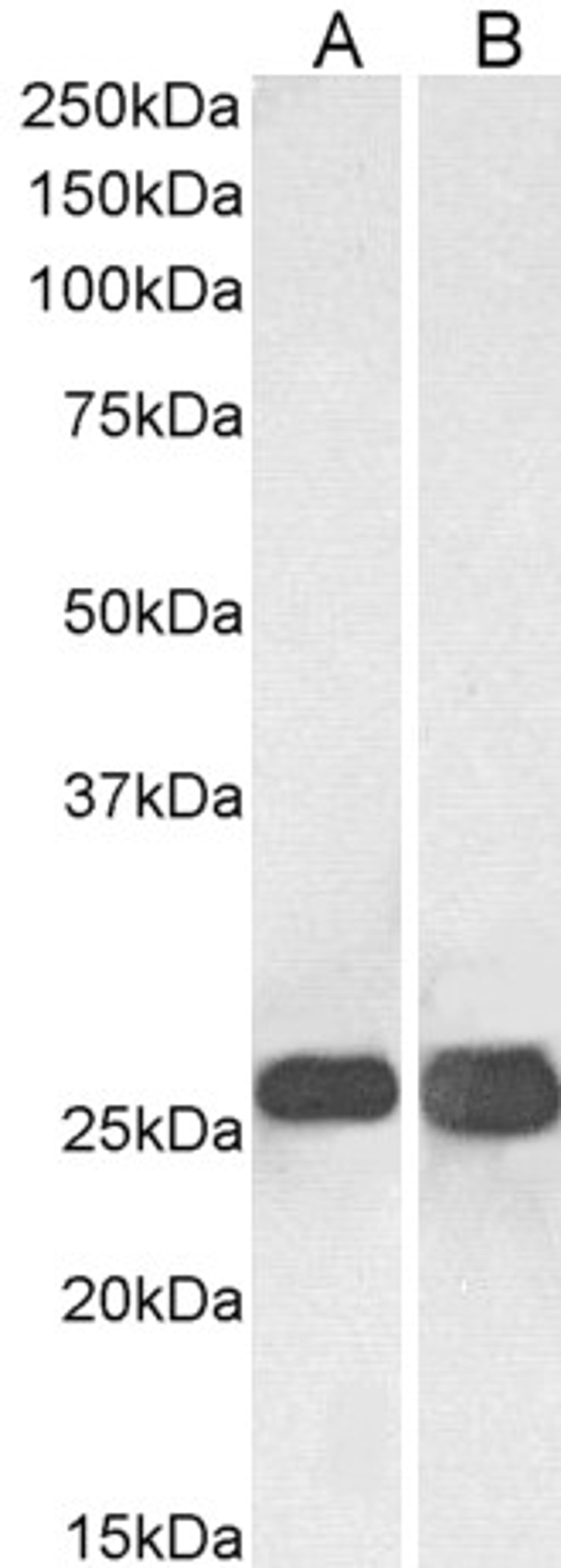 45-149 (0.03ug/ml) staining of Human Brain (Cerebellum) (A) and Mouse Brain (B lysates (35ug protein in RIPA buffer). Primary incubation was 1 hour. Detected by chemiluminescence.