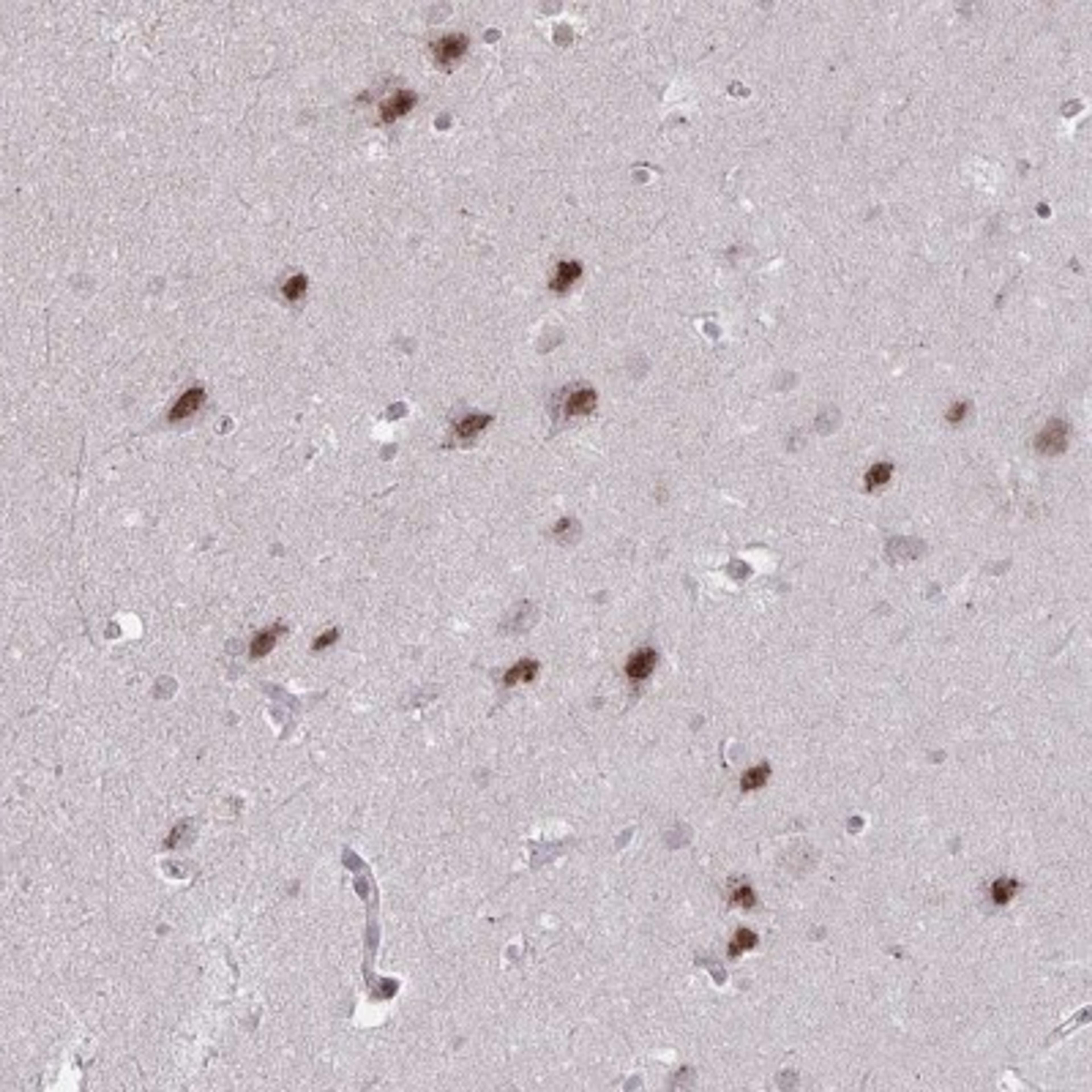 Immunohistochemistry: DAGLA Antibody [NBP2-31856] - Immunohistochemical staining of human hippocampus shows moderate nuclear positivity in neuronal cells.