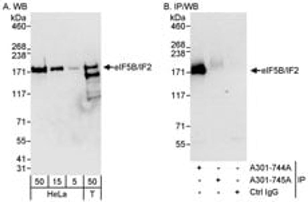 Detection of human eIF5B/IF2 by western blot and immunoprecipitation.