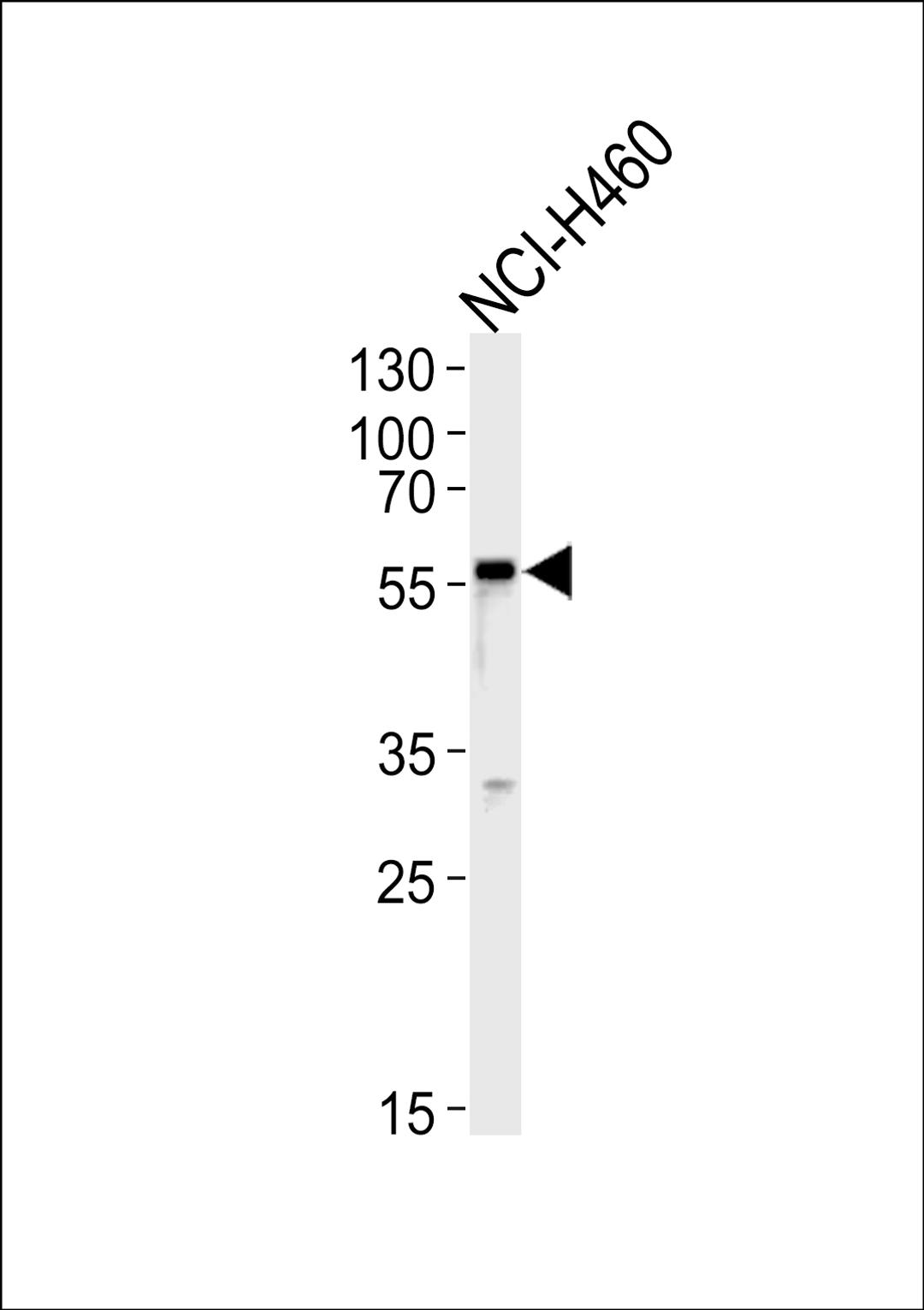 Western blot analysis in NCI-H460 cell line lysates (35ug/lane).