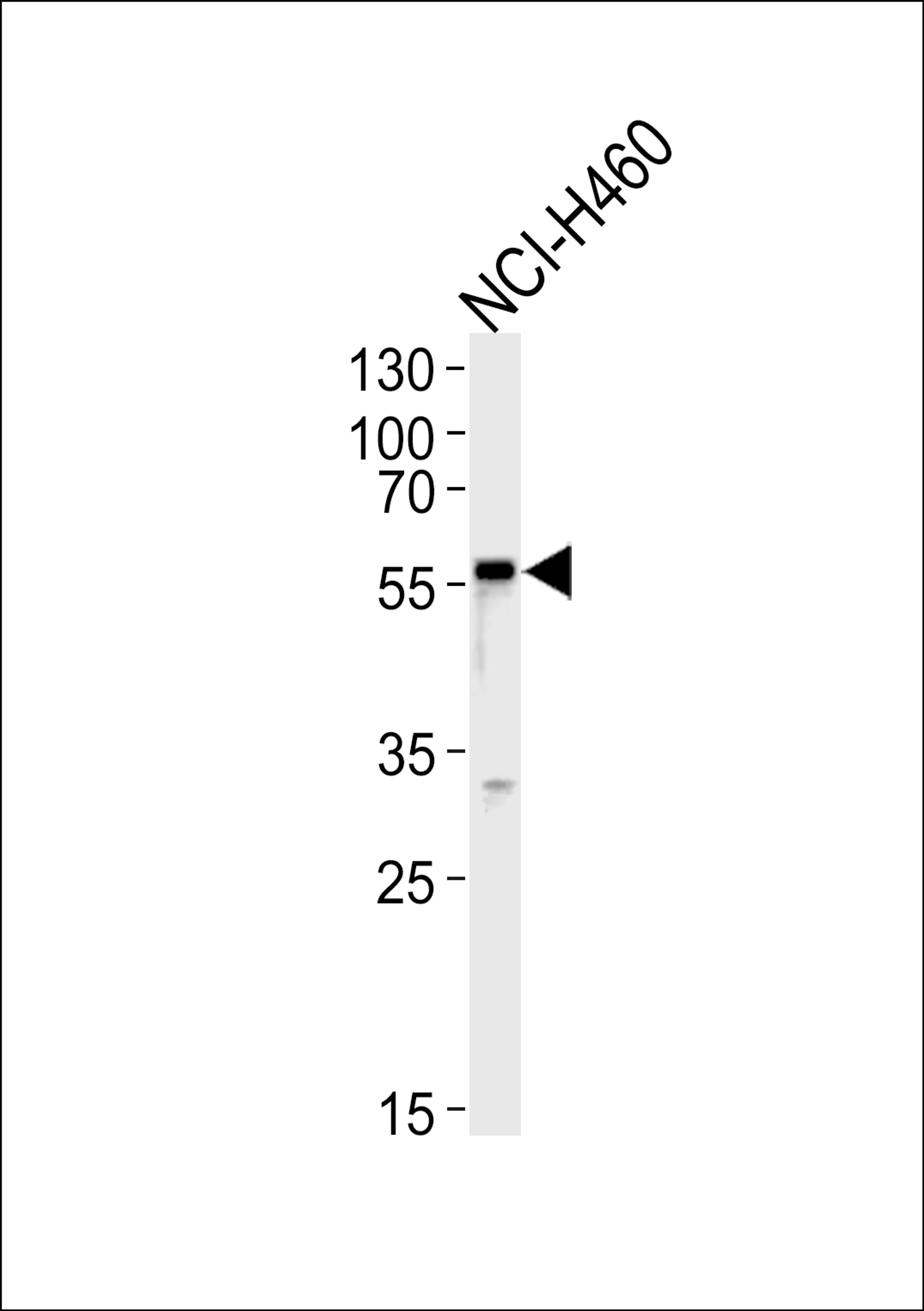 Western blot analysis in NCI-H460 cell line lysates (35ug/lane).