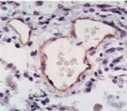 Immunohistochemistry-Paraffin: eNOS Antibody [NB300-500] - Staining of eNOS in human lung tissue.